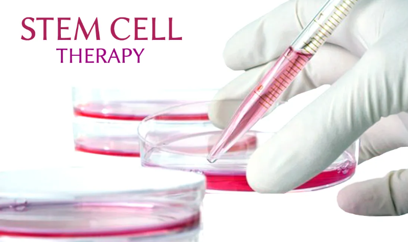 Promising Stem Cell Treatments for Multiple Sclerosis