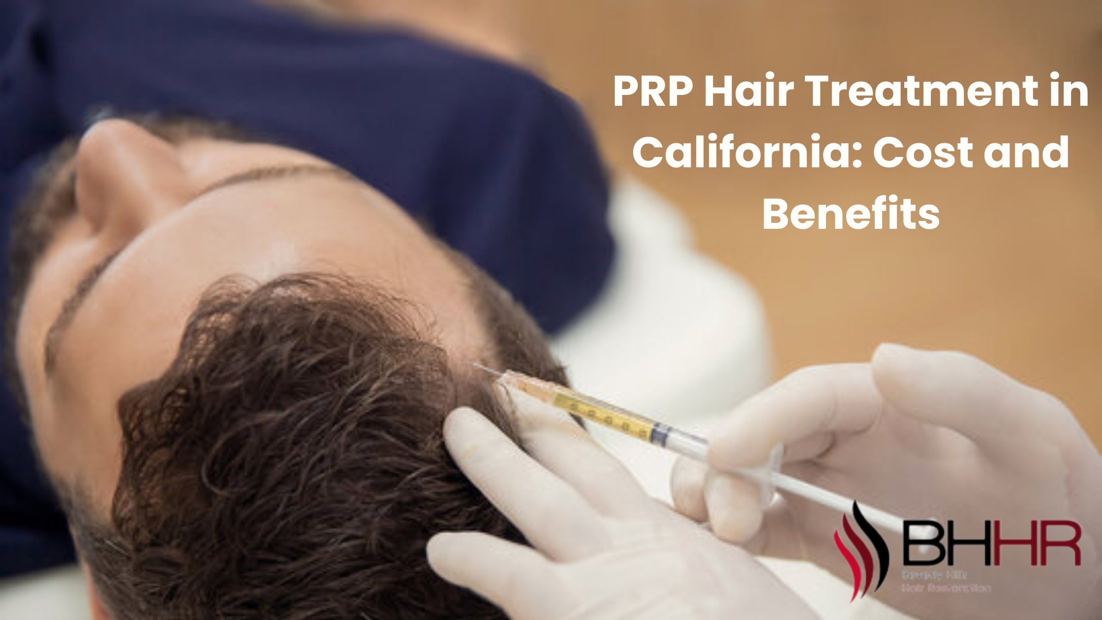 prp hair treatment cost california